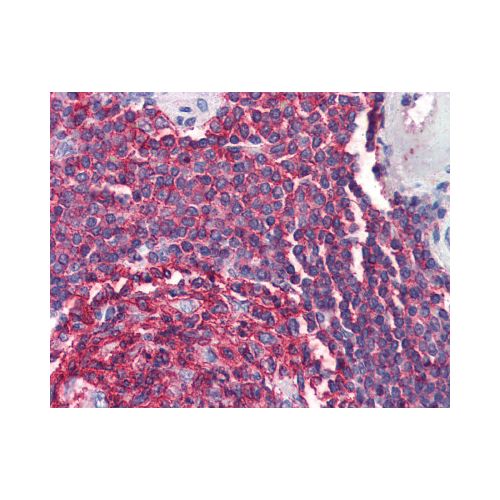 CD20 (C-Terminus) antibody