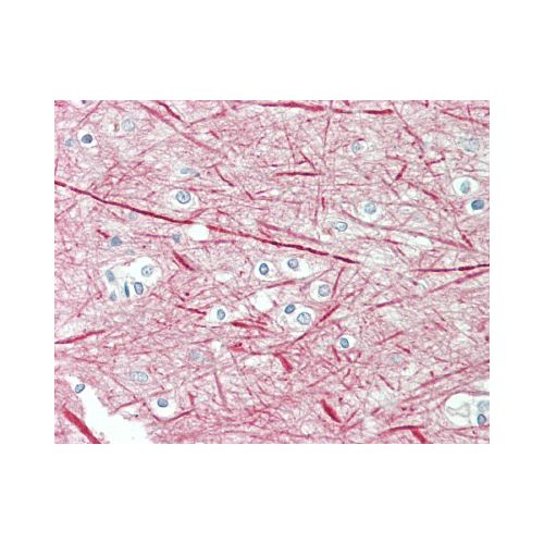 NEFM / NF-M (Internal) antibody