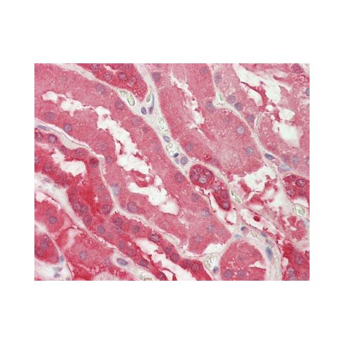 LDHB / LDH-B (aa15-25) antibody