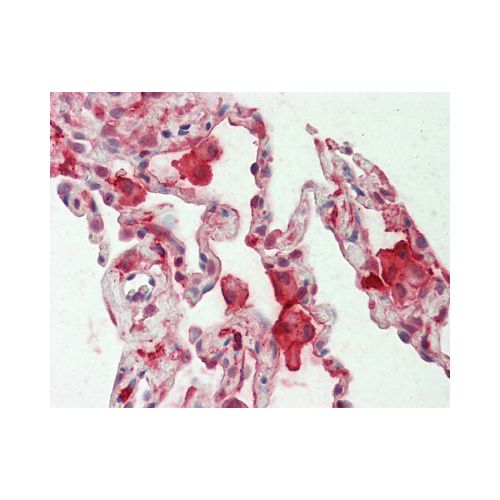 CAPG / MCP (aa205-217) antibody