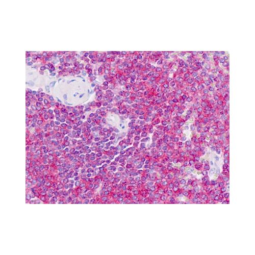 RAC2 antibody (AT2G11)