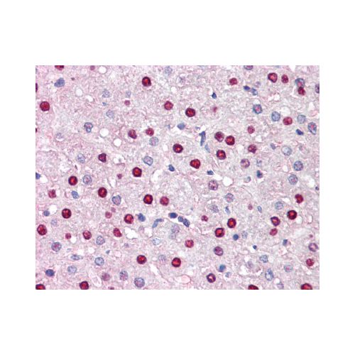 KDM5C / Jarid1C / SMCX (C-Terminus) antibody