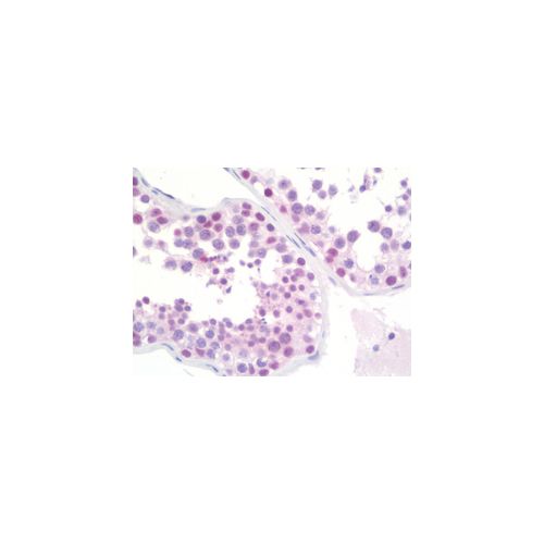 TRMT2A antibody (1G8)