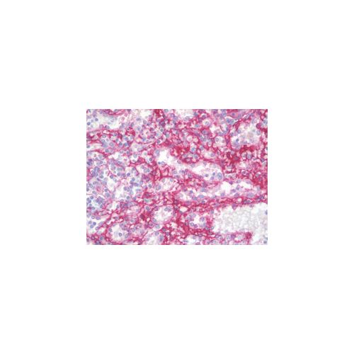 CD105 antibody (8A1)