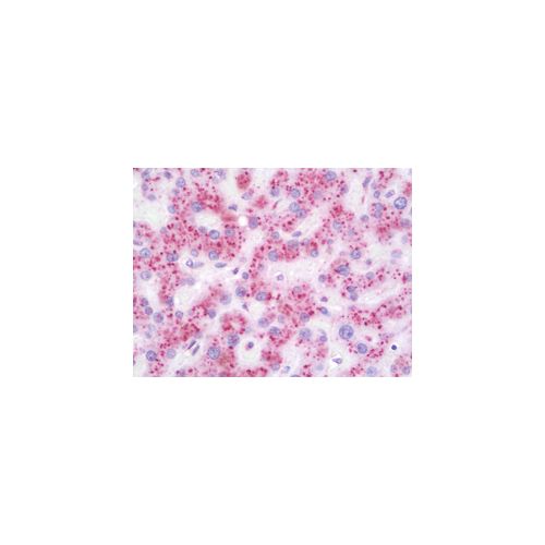 GLB1 / Beta-Galactosidase antibody (5H2)