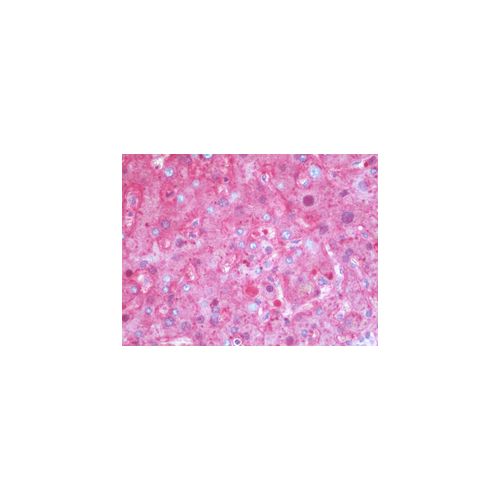 SERPINA1 / Alpha 1 Antitrypsin antibody (11G2)