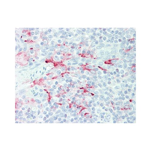 MSLN / Mesothelin (Extracellular Domain) antibody (MN-1)
