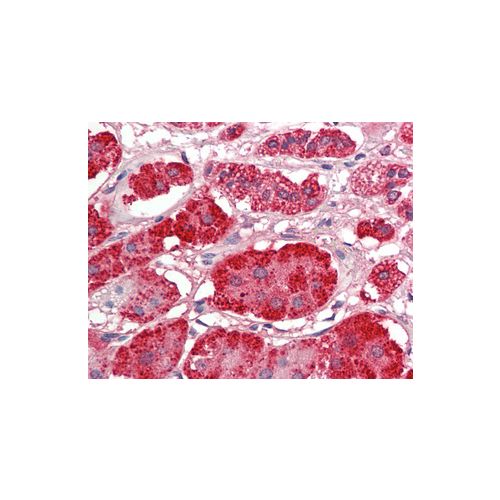 ACACB (Internal) antibody