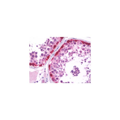 MAGEA3 antibody (4E2)