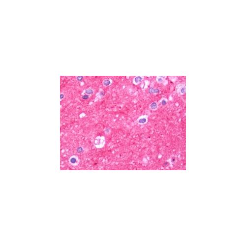 THY1 antibody (5E10)