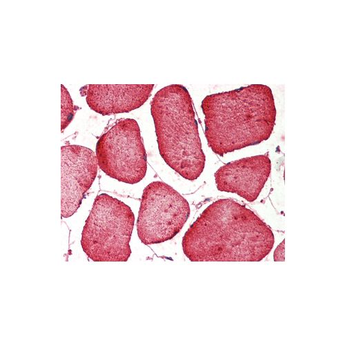 TSC1 antibody (357CT4.4.2)