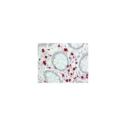 ALOX15 antibody (7H6)