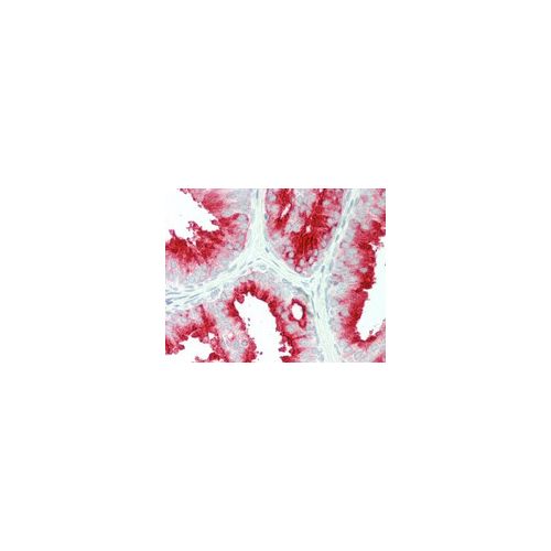 FOLH1 antibody (3H5)