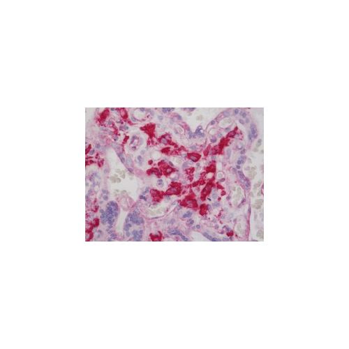 FCGR1A antibody (1A8)