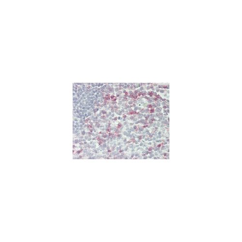 PDCD1 antibody (3C6)