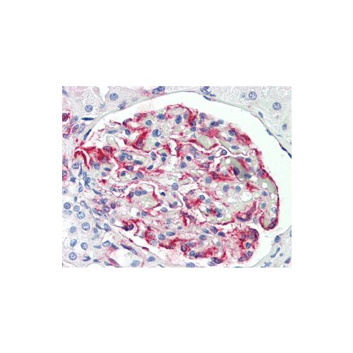PEAK1 (aa672-699) antibody
