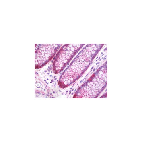 TIAM1 (aa1478-1506) antibody