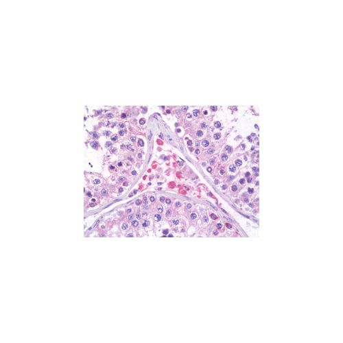 PRICKLE2 (Internal) antibody