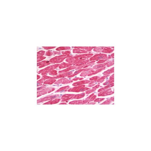 IL1RL2 (Internal) antibody