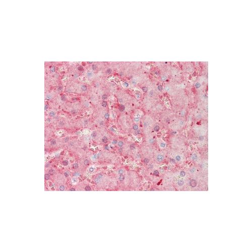 F11 antibody