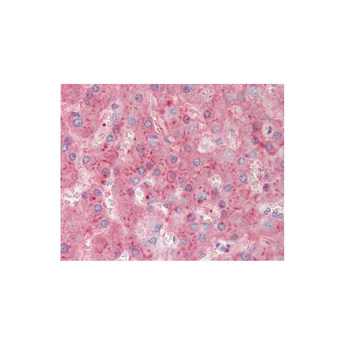 VTN antibody