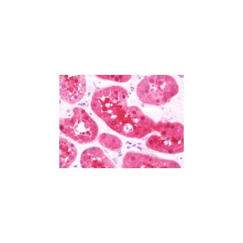 PSPH (aa1-175) antibody
