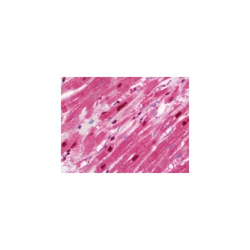 HSPA6 (aa377-628) antibody