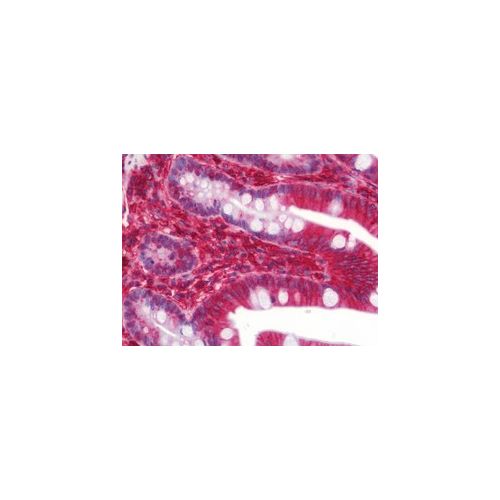 HLA-A antibody