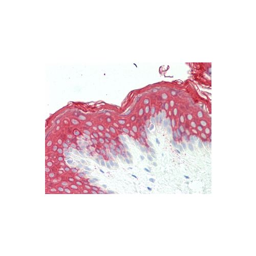 KRT10 (aa157-187) antibody
