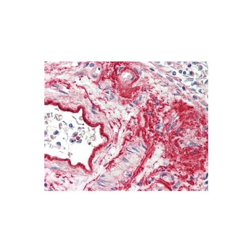 COL8A1 (aa575-743) antibody