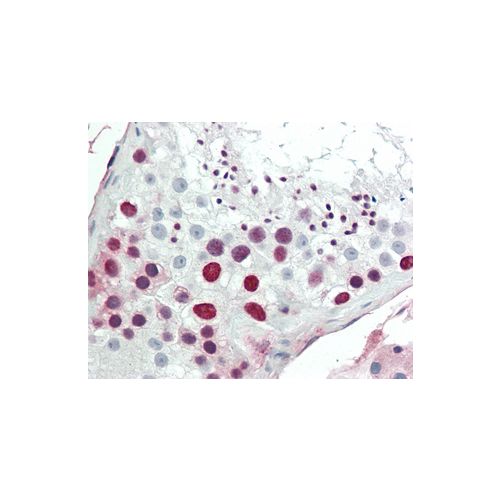 HMGA1 (aa1-53) antibody