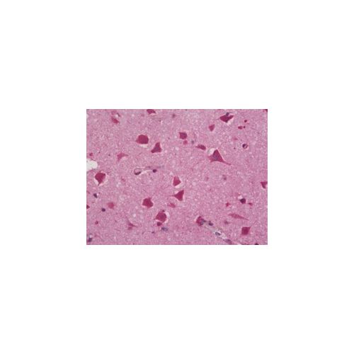 SCN1B (N-Terminus) antibody
