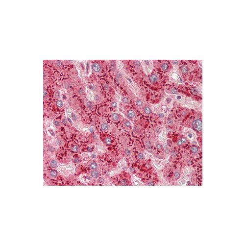 SAA1 (aa1-106) antibody