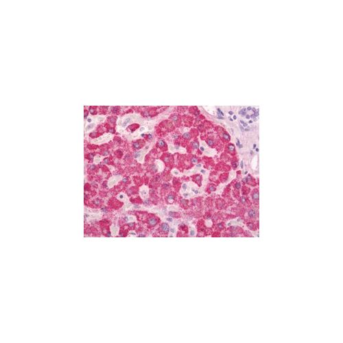 LPGAT1 (aa49-198) antibody