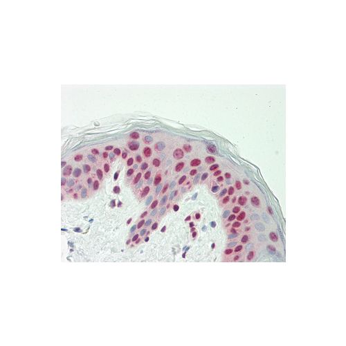 RAF1 (aa85-113) antibody