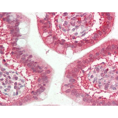 CFTR (C-Terminus) antibody
