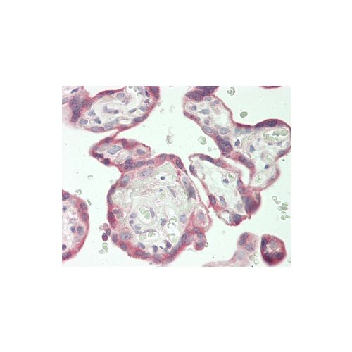 TGFBR2 (aa13-40) antibody