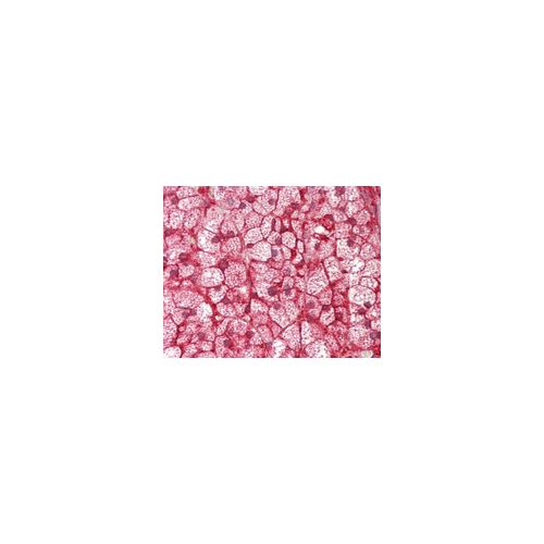 CYP21A2 (aa224-253) antibody