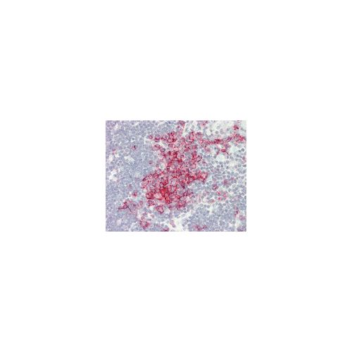 MS4A1 antibody