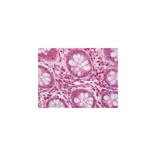 NPHP1 antibody