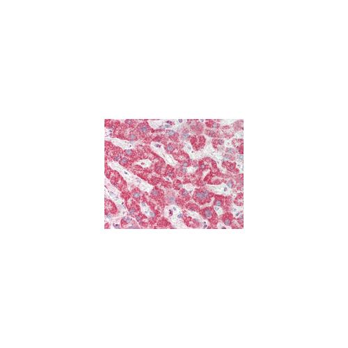 CHI3L1 antibody
