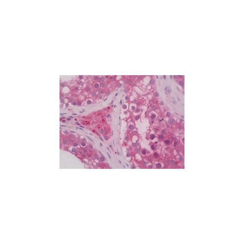 RAB5A (C-Terminus) antibody