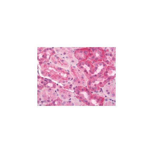 SLC9A1 antibody
