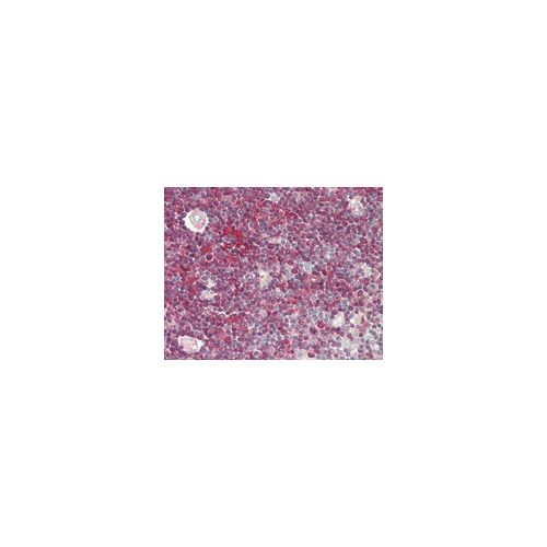 IL18R1 (aa32-329) antibody