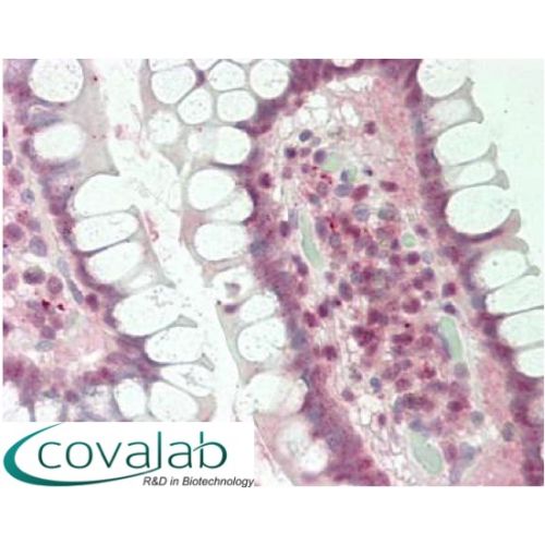 DDIT3 antibody