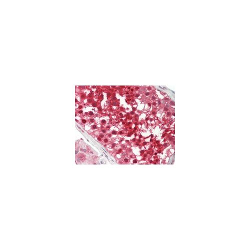 PSMB5 antibody