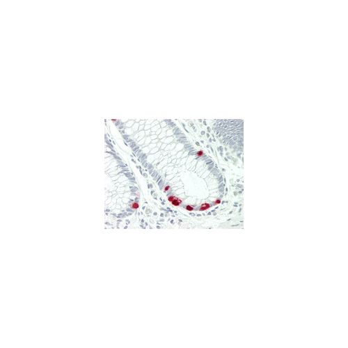 ABCC5 antibody (6C6)
