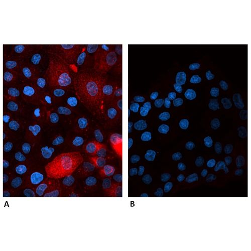 beta2-Microglobulin antibody (B2M-01)