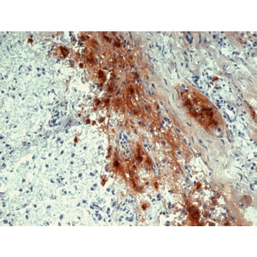 beta Endorphin antibody (B31.15)