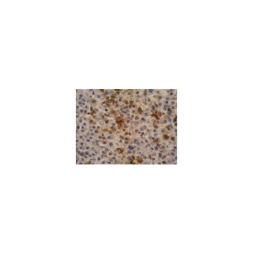 alpha-Fetoprotein antibody (AFP-11)